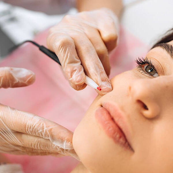 &eacute;pilation d&eacute;finitive &eacute;lectrique - centre my laser - lausanne