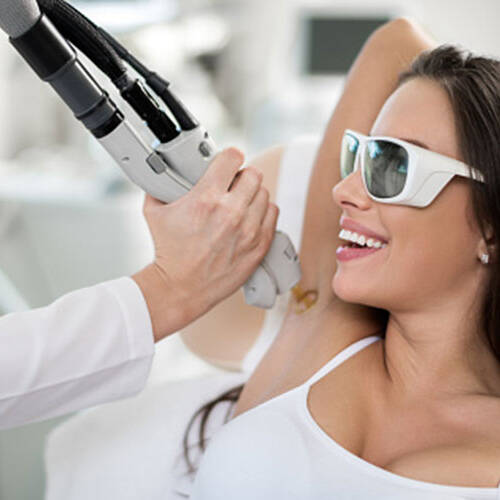 &eacute;pilation laser d&eacute;finitive femmes Lausanne