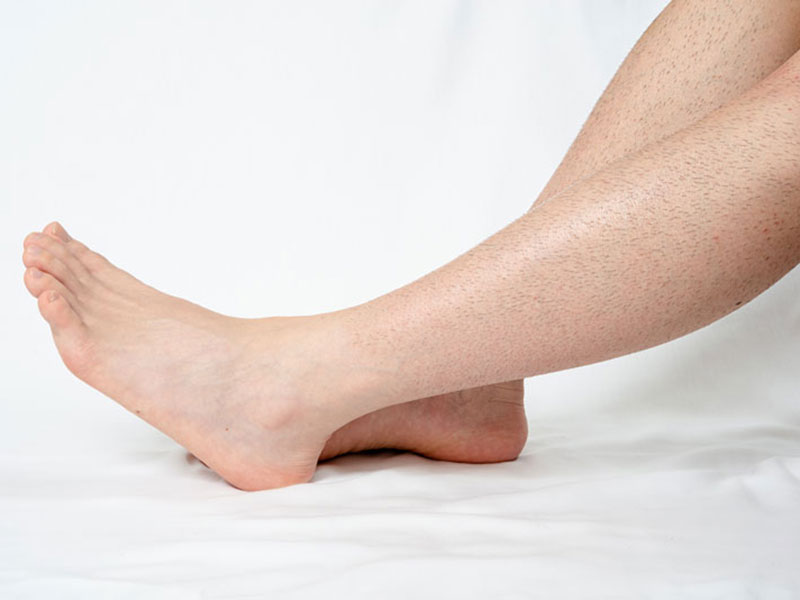 jambe avant - my laser