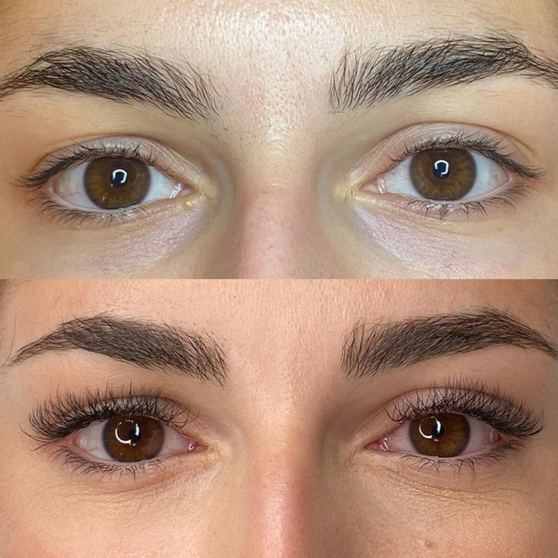 Extensions cils &agrave; cils - My Laser Lausanne