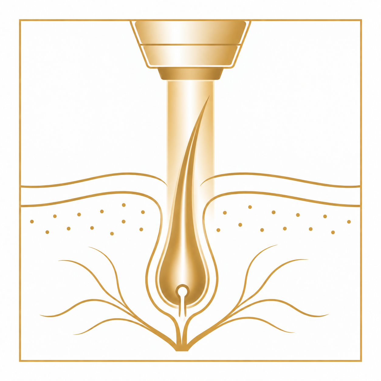 comment fonctionne le laser - my laser lausanne
